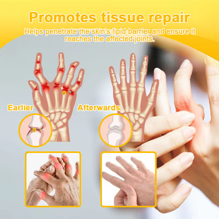 đFlash Sale Odeiun⢠Botulinum Toxin & Bee Venom Pain-Relief Bone Healing Cream