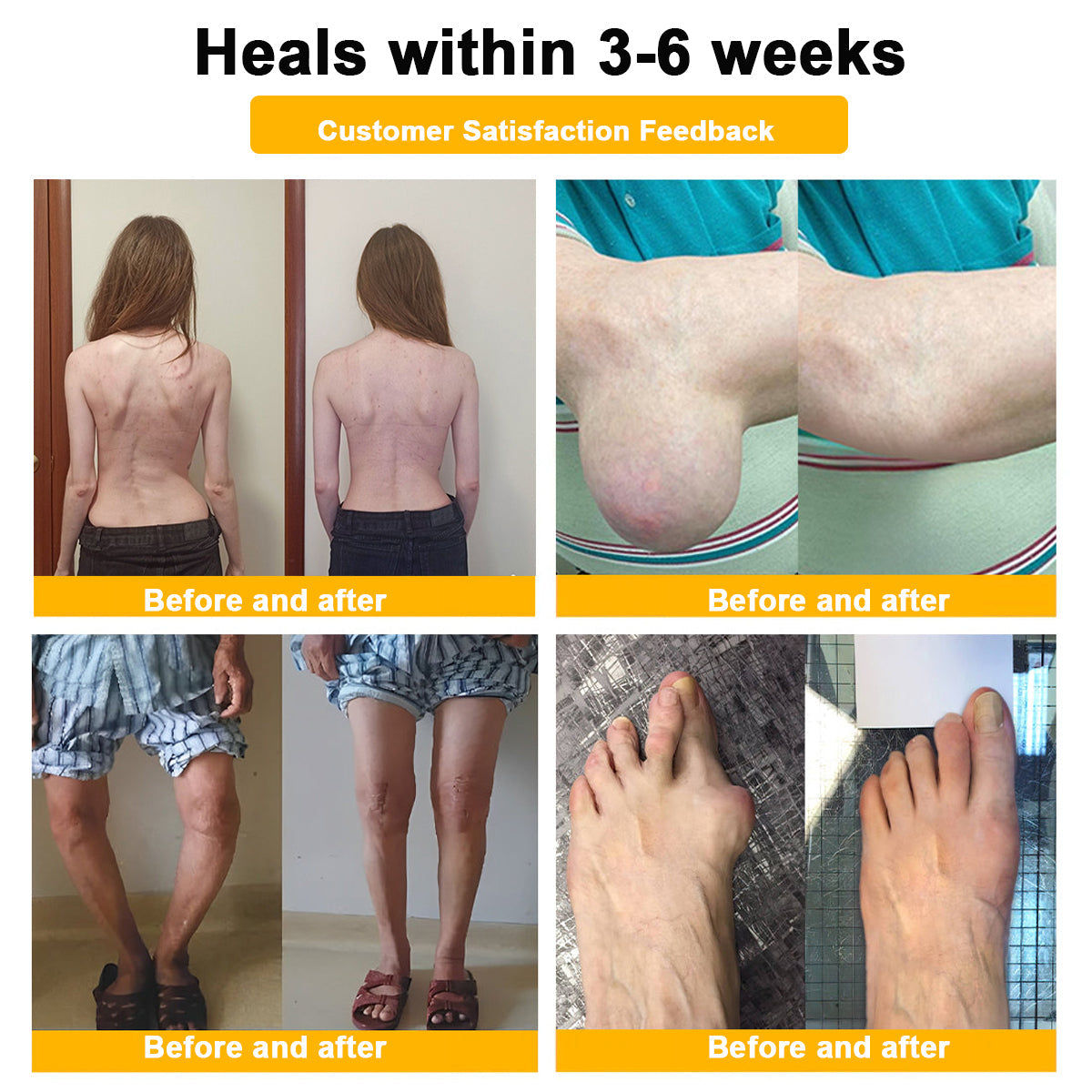đFlash Sale Odeiun⢠Botulinum Toxin & Bee Venom Pain-Relief Bone Healing Cream