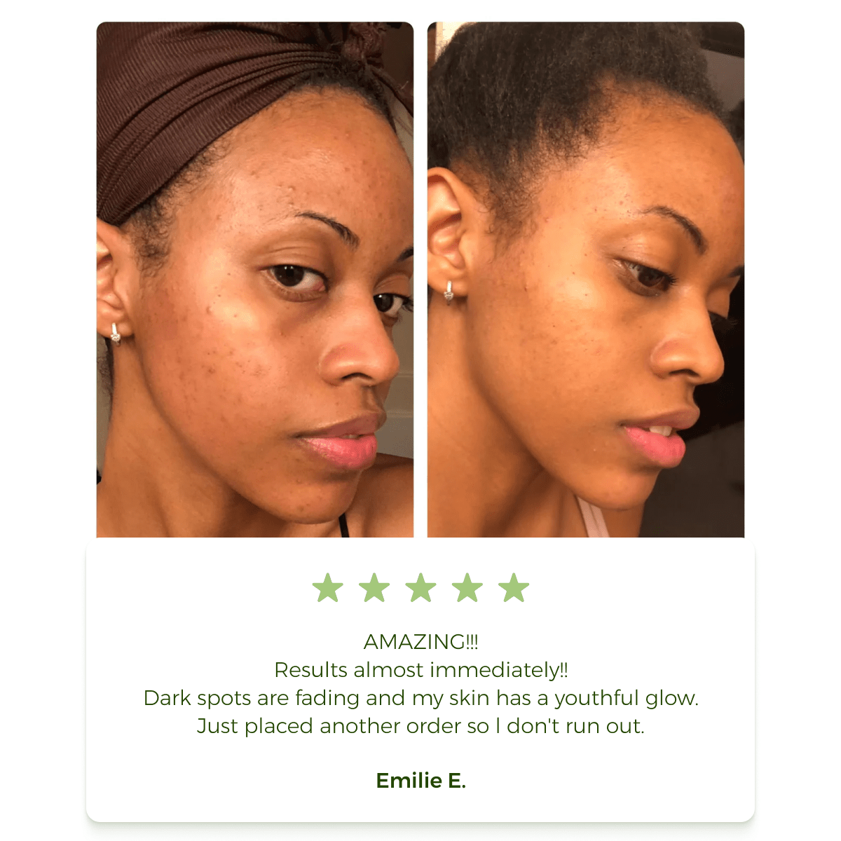 Clearance Blowout! 🚨 Anti-Acne & Dark Spots African Soap