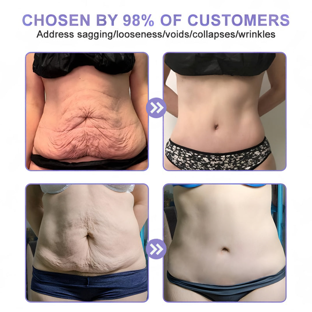 đ«ăOfficial Brandă ODEIUNâą Body Firming Cream â Smooth, Tighten & Restore Sagging Skin