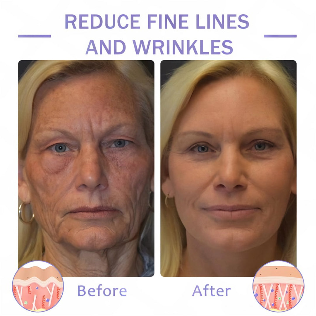 đ«ăOfficial Brandă ODEIUNâą Body Firming Cream â Smooth, Tighten & Restore Sagging Skin