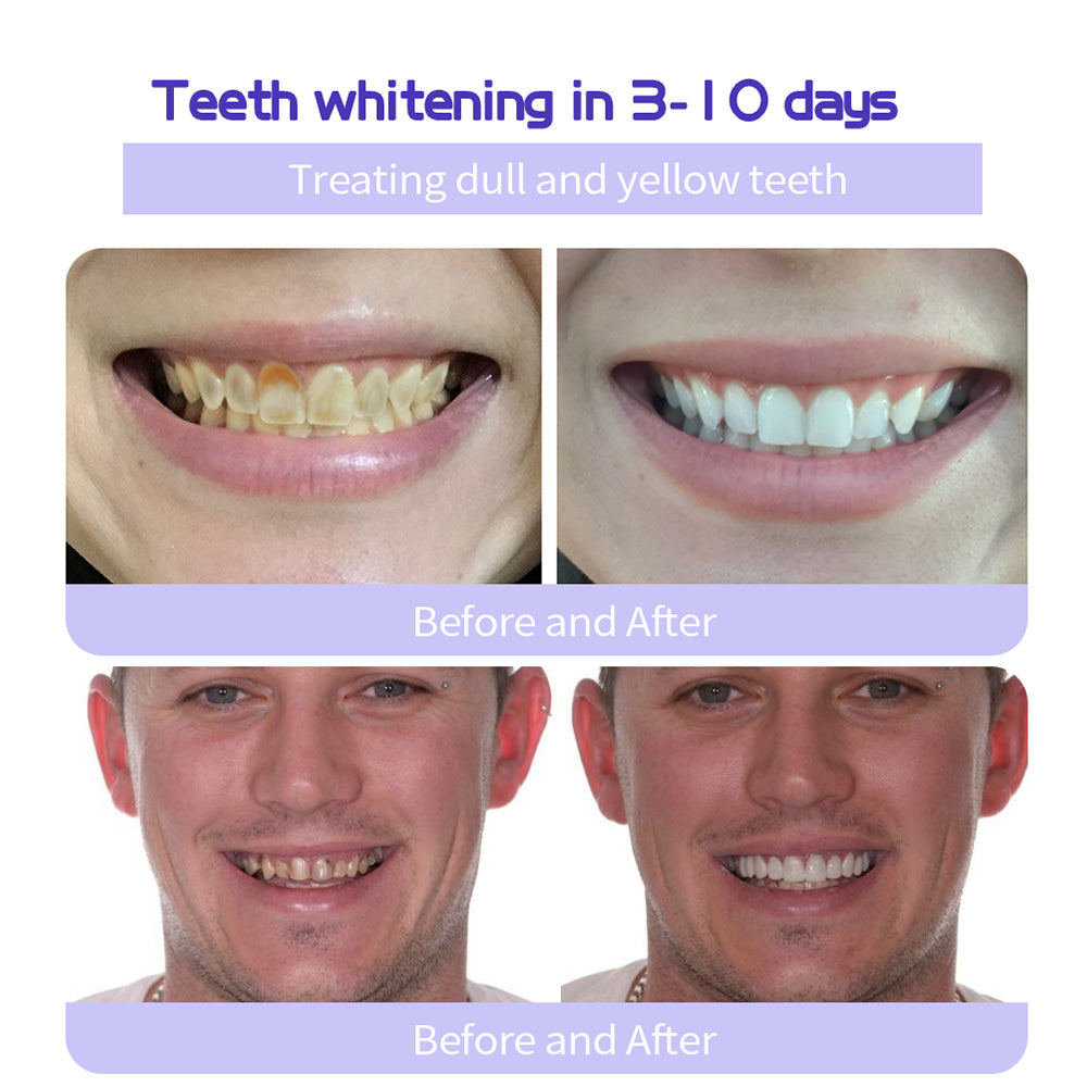 Official Store | Seurico™ Tooth Health Mineral Powder - ✅ TGA-Certified 🎁 Flash Sale - Don’t Miss Out