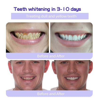 Official Store | Seurico™ Tooth Health Mineral Powder - ✅ TGA-Certified 🎁 Flash Sale - Don’t Miss Out