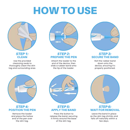 Odeiun™ Painless At-home Skin Tag Removal Pen
