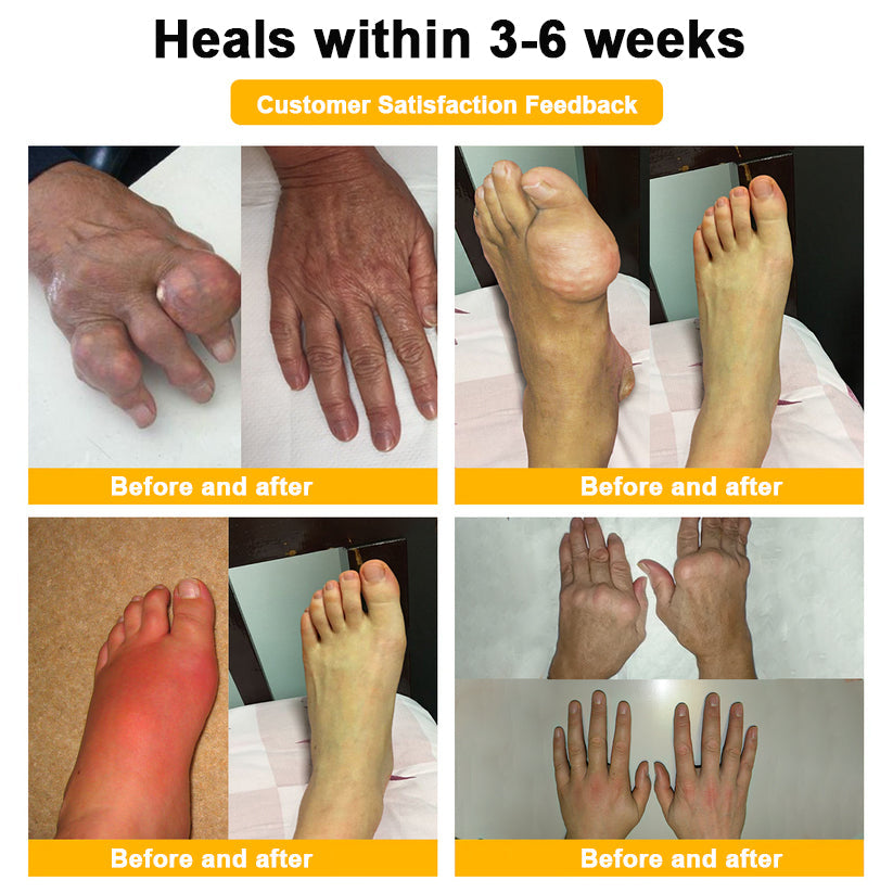 🎁Flash Sale Odeiun™ Botulinum Toxin & Bee Venom Pain-Relief Bone Healing Cream