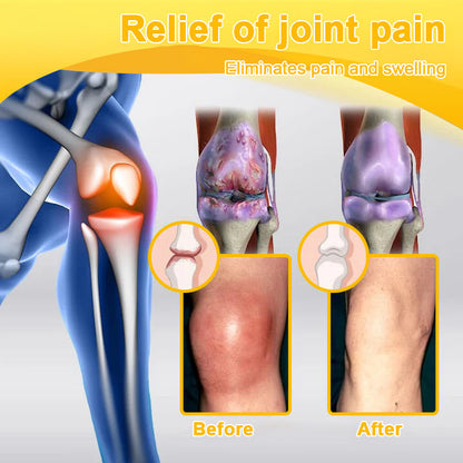🎁Flash Sale Odeiun™ Botulinum Toxin & Bee Venom Pain-Relief Bone Healing Cream