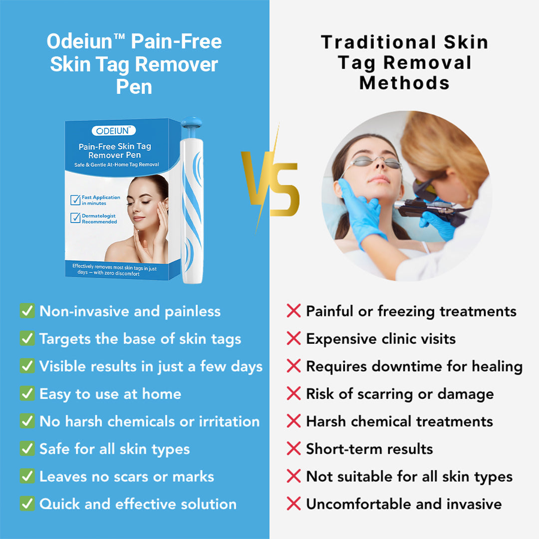 Odeiun™ Painless At-home Skin Tag Removal Pen