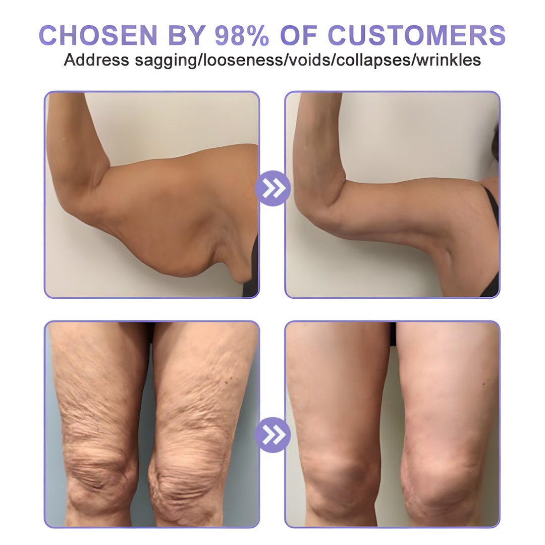 🫐【Official Brand】 ODEIUN™ Body Firming Cream – Smooth, Tighten & Restore Sagging Skin