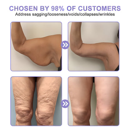 🫐【Official Brand】 ODEIUN™ Body Firming Cream – Smooth, Tighten & Restore Sagging Skin