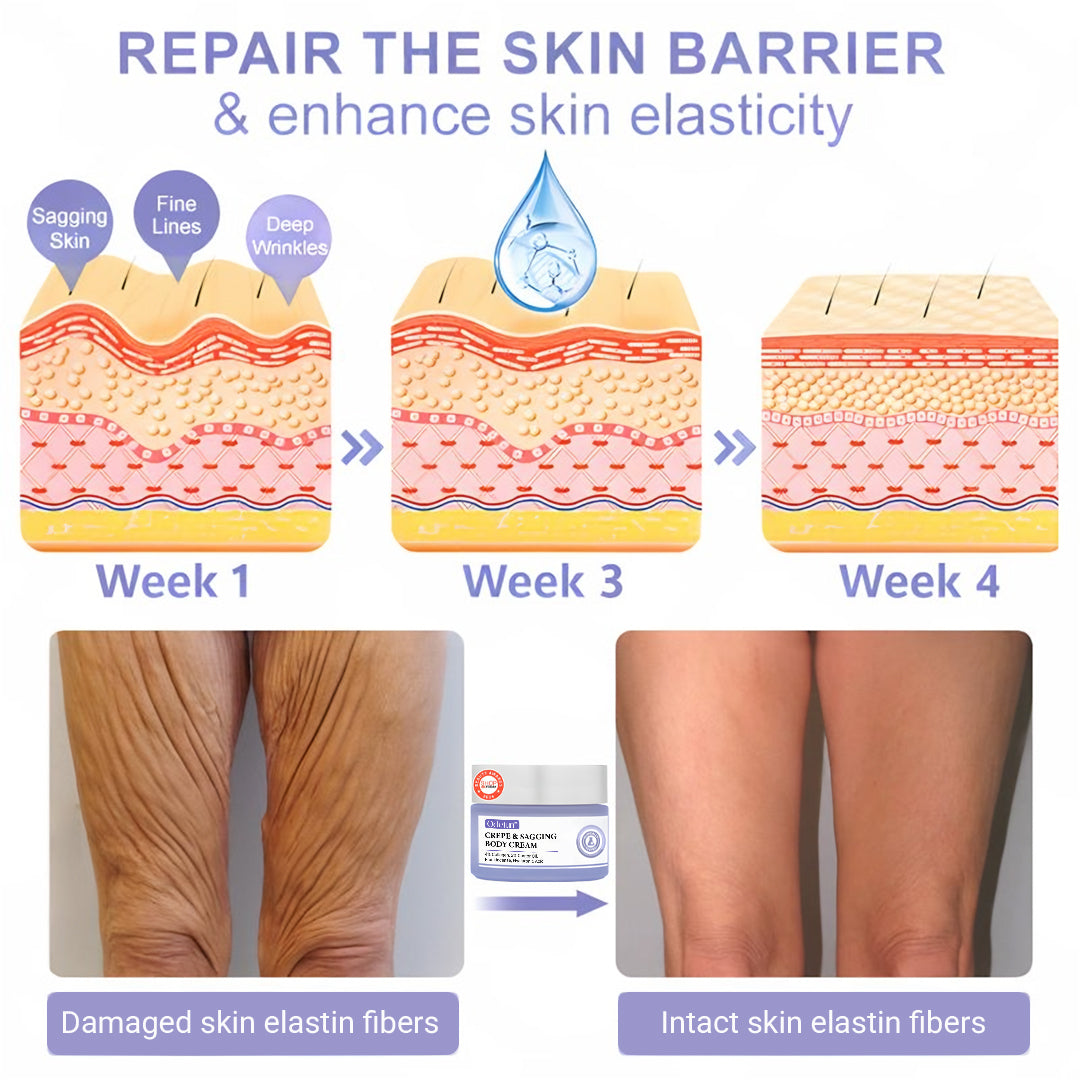 🫐【Official Brand】 ODEIUN™ Body Firming Cream – Smooth, Tighten & Restore Sagging Skin