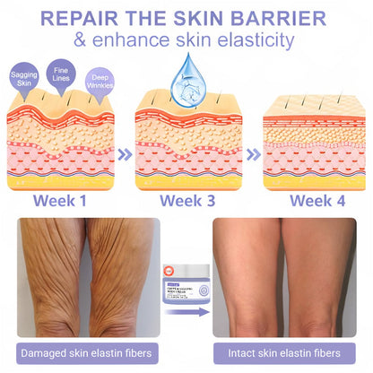 🫐【Official Brand】 ODEIUN™ Body Firming Cream – Smooth, Tighten & Restore Sagging Skin