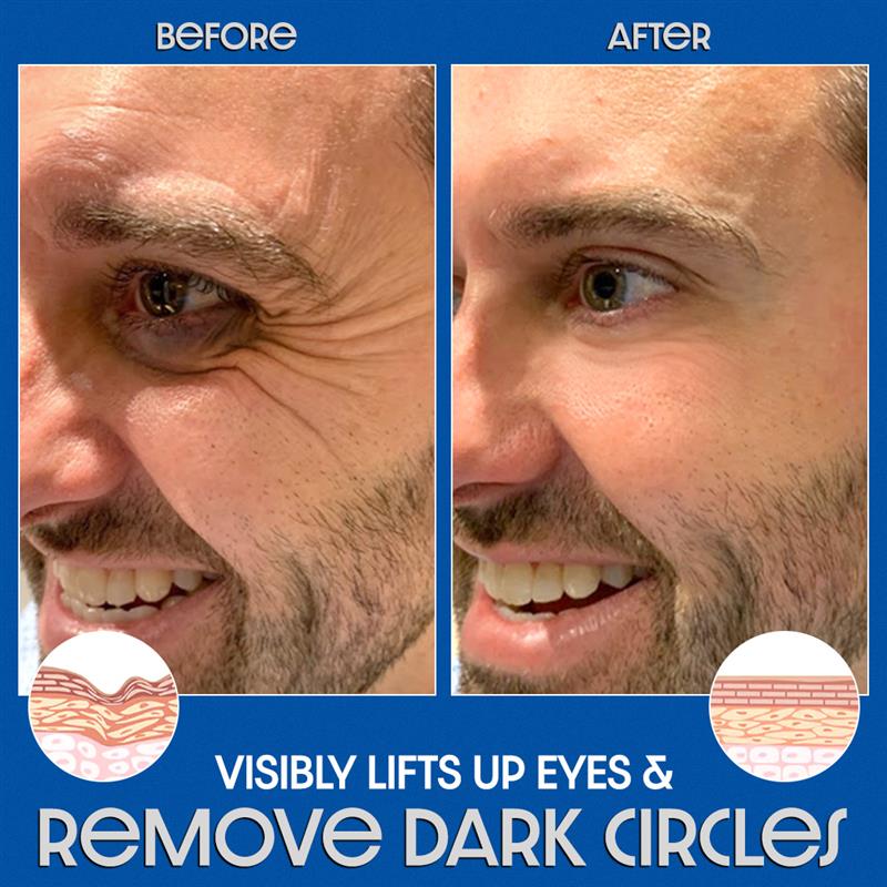 🔥ODEIUN™ Awaken Peptide Lifting Eye Gel – Revitalize & Firm Your Eyes with Advanced Peptide Technology