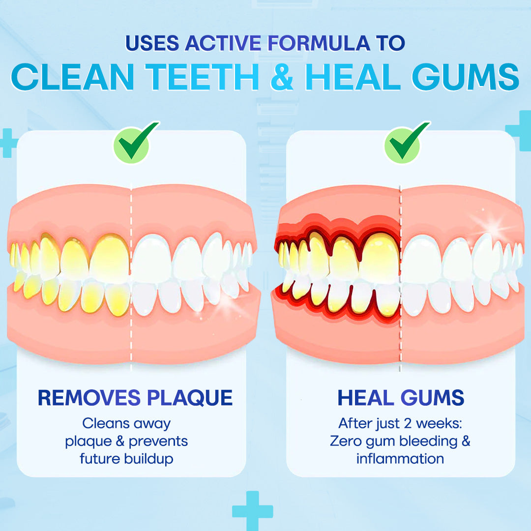 🔥Last Day 75% OFF--🦷 Negusy™ Gum Therapy Agent