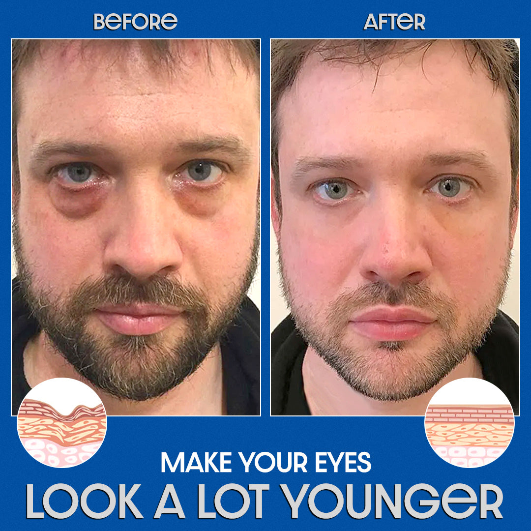 🔥ODEIUN™ Awaken Peptide Lifting Eye Gel – Revitalize & Firm Your Eyes with Advanced Peptide Technology