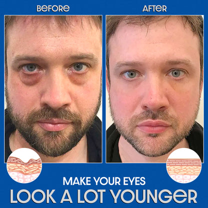 🔥ODEIUN™ Awaken Peptide Lifting Eye Gel – Revitalize & Firm Your Eyes with Advanced Peptide Technology