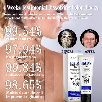 🚀70% OFF Ends Tonight! - Negusy™ Tattoo Dissolving Gel