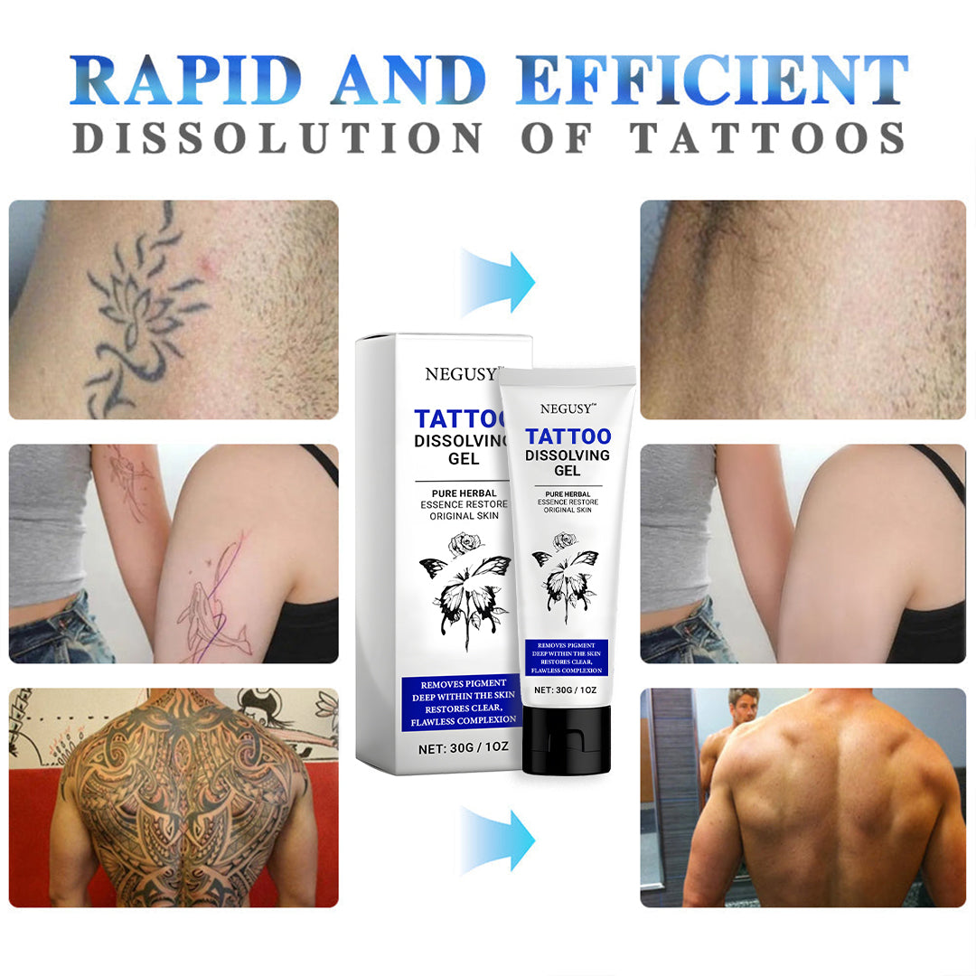 🚀70% OFF Ends Tonight! - Negusy™ Tattoo Dissolving Gel