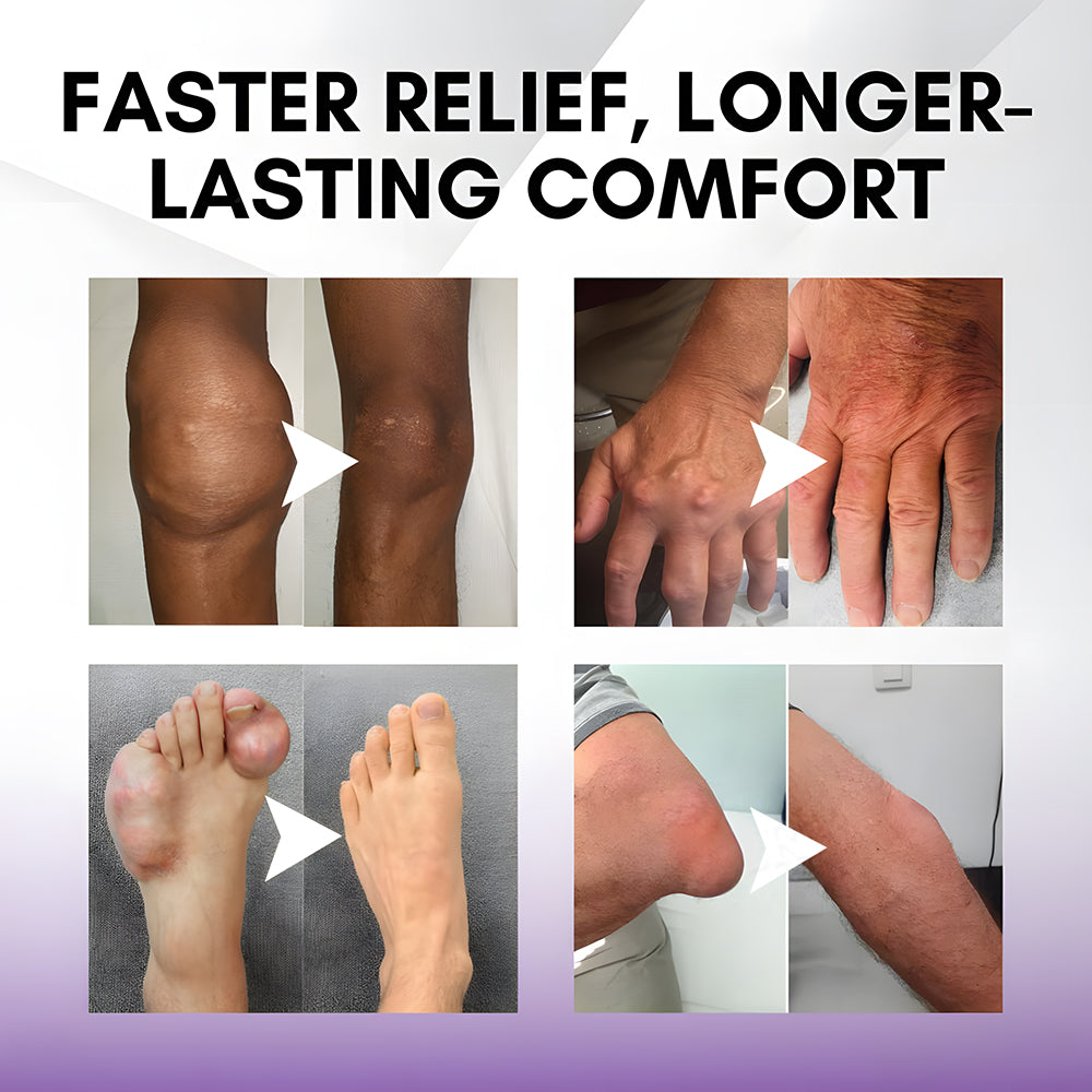 Seurico™ Turmeric & Emu Oil Arthritis Soothing Pain Relief Massage Gel