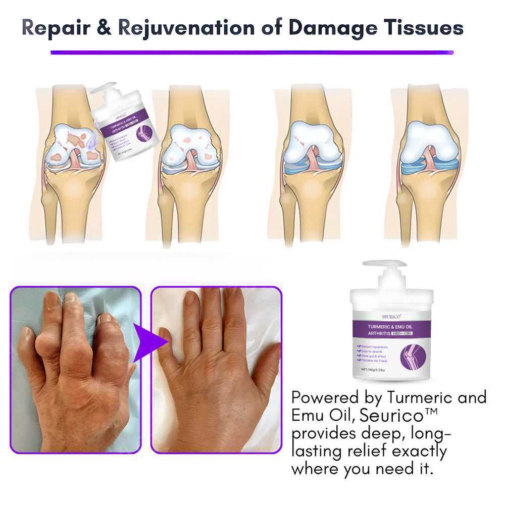 Seurico™ Turmeric & Emu Oil Arthritis Soothing Pain Relief Massage Gel